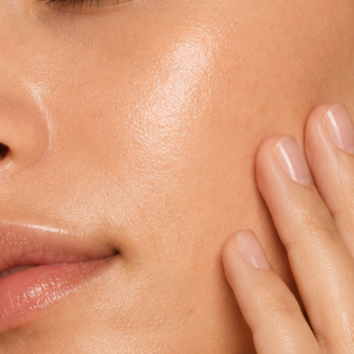OILY SKIN